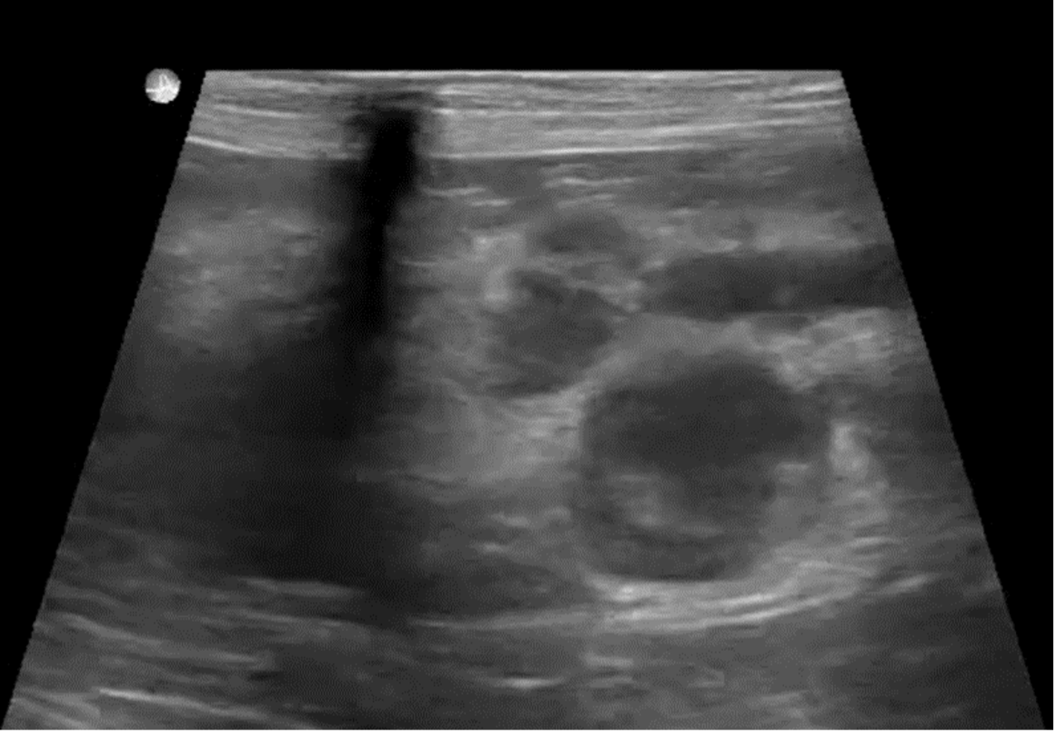 Ultrasound Characteristics Of Canine Pancreatitis   Blog Pic 2 